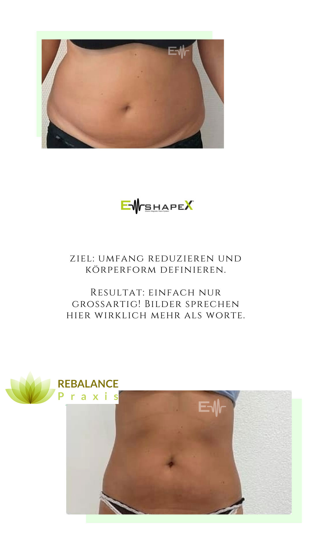 EMShape X